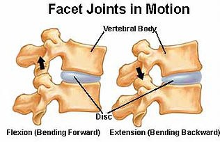 physical therapy facet joints