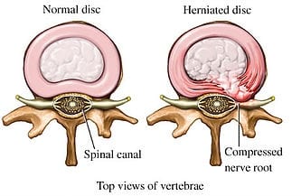 Top View of Vertebrae Anatomy