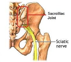 physical therapy sacroiliac image