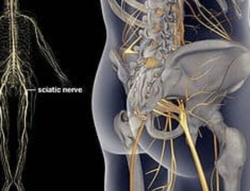 Sciatic Nerve Pain: 5 Things You Should Know