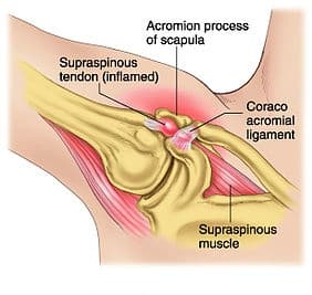 physical therapy shoulder image