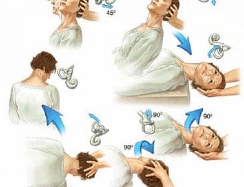 Vertigo – Testing & Treatment (Part 2 of 2)