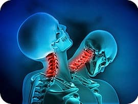 physical therapy whiplash image