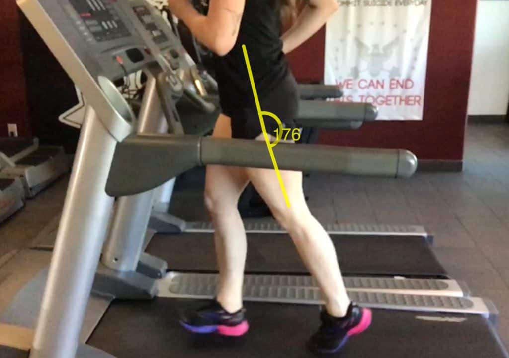 Lacking Hip Extension Gait Analysis 178 degrees - Scottsdale, AZ