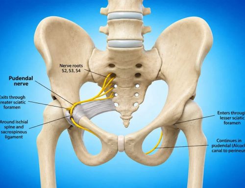 The Pelvic Pain No One Has Been Able to Name