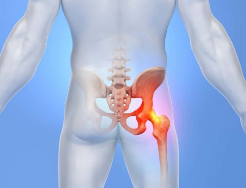 You Were Told Your Hip Would Only Get Worse. Here Is What They May Have Missed