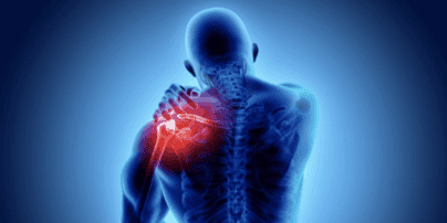 Rotator Cuff Pain - Physical Therapy