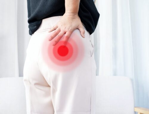 The Role of Physical Therapy in Treating Sciatic Nerve Pain
